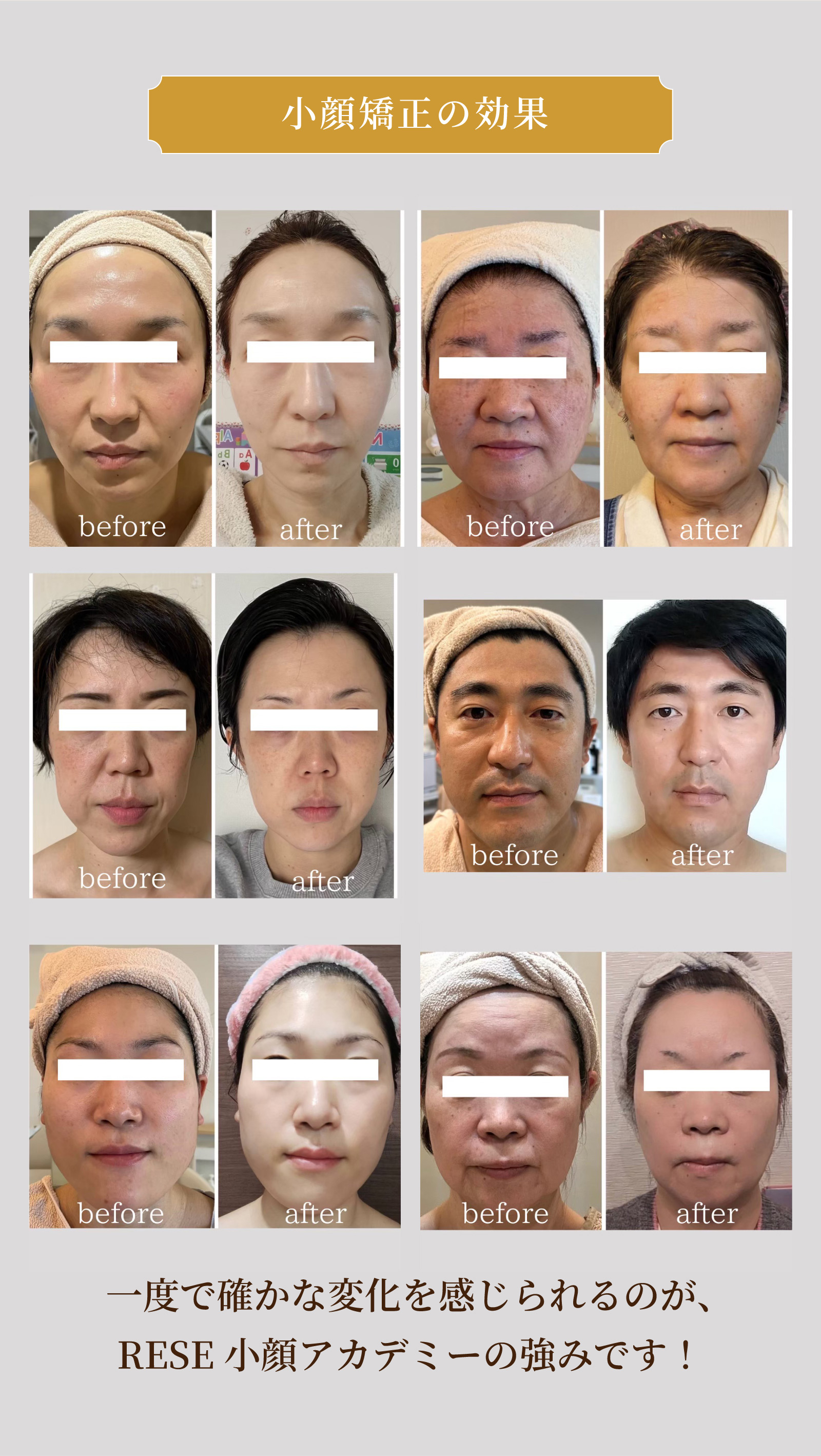 小顔矯正の効果